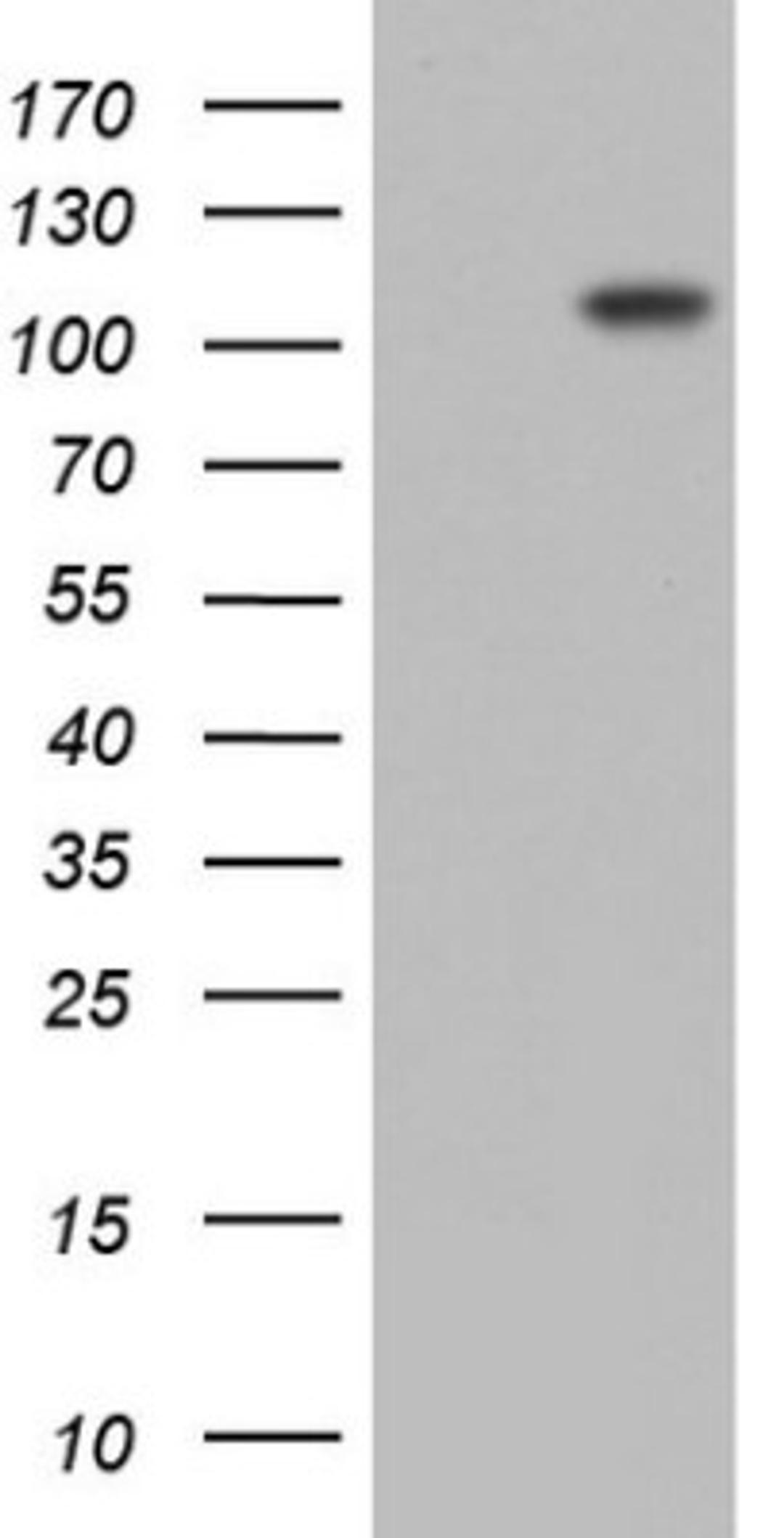 Western Blot: Lysine Hydroxylase 2/PLOD2 Antibody (6D1) [NBP2-46451] - Analysis of HEK293T cells were transfected with the pCMV6-ENTRY control (Left lane) or pCMV6-ENTRY PLOD2.