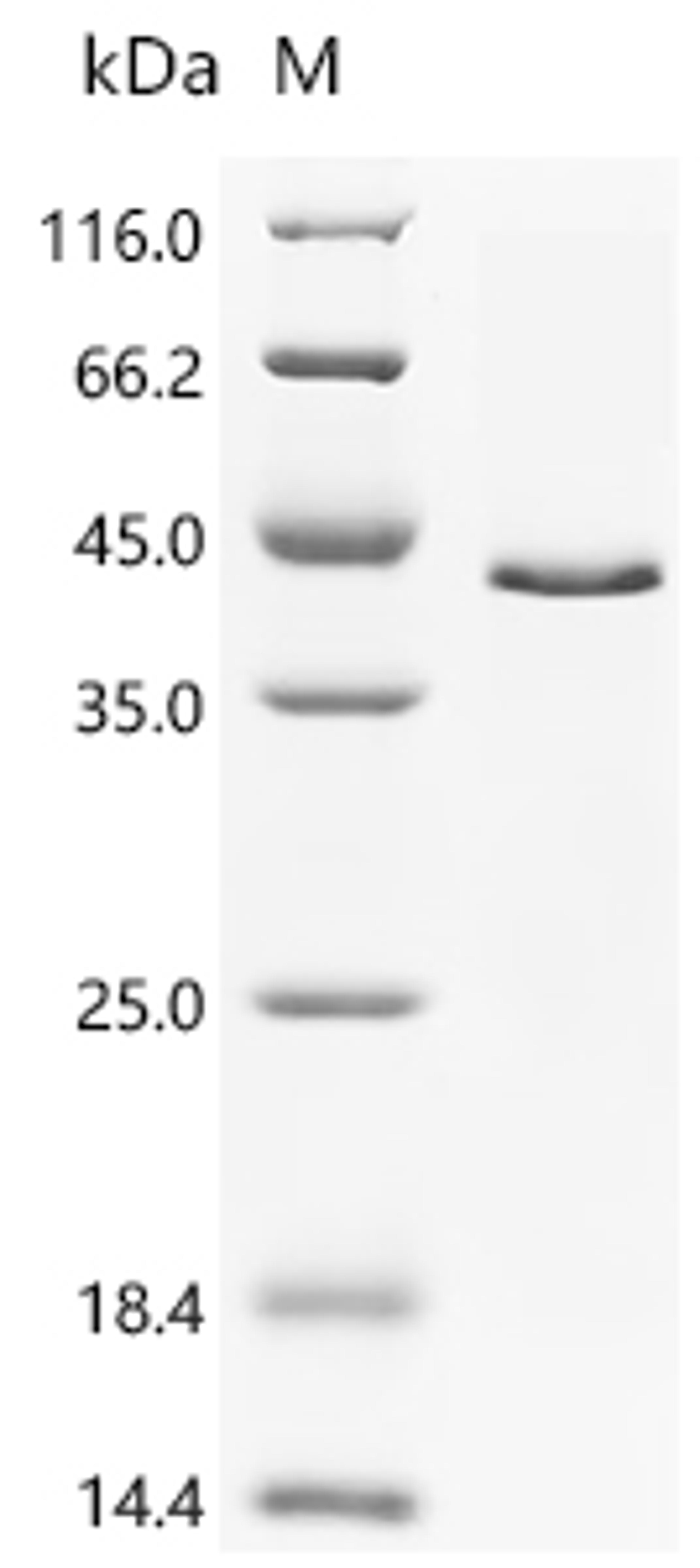 (Tris-Glycine gel) Discontinuous SDS-PAGE (reduced) with 5% enrichment gel and 15% separation gel.
