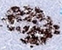 Formalin-fixed, paraffin-embedded human pancreas stained with anti-Insulin antibody (SPM531).