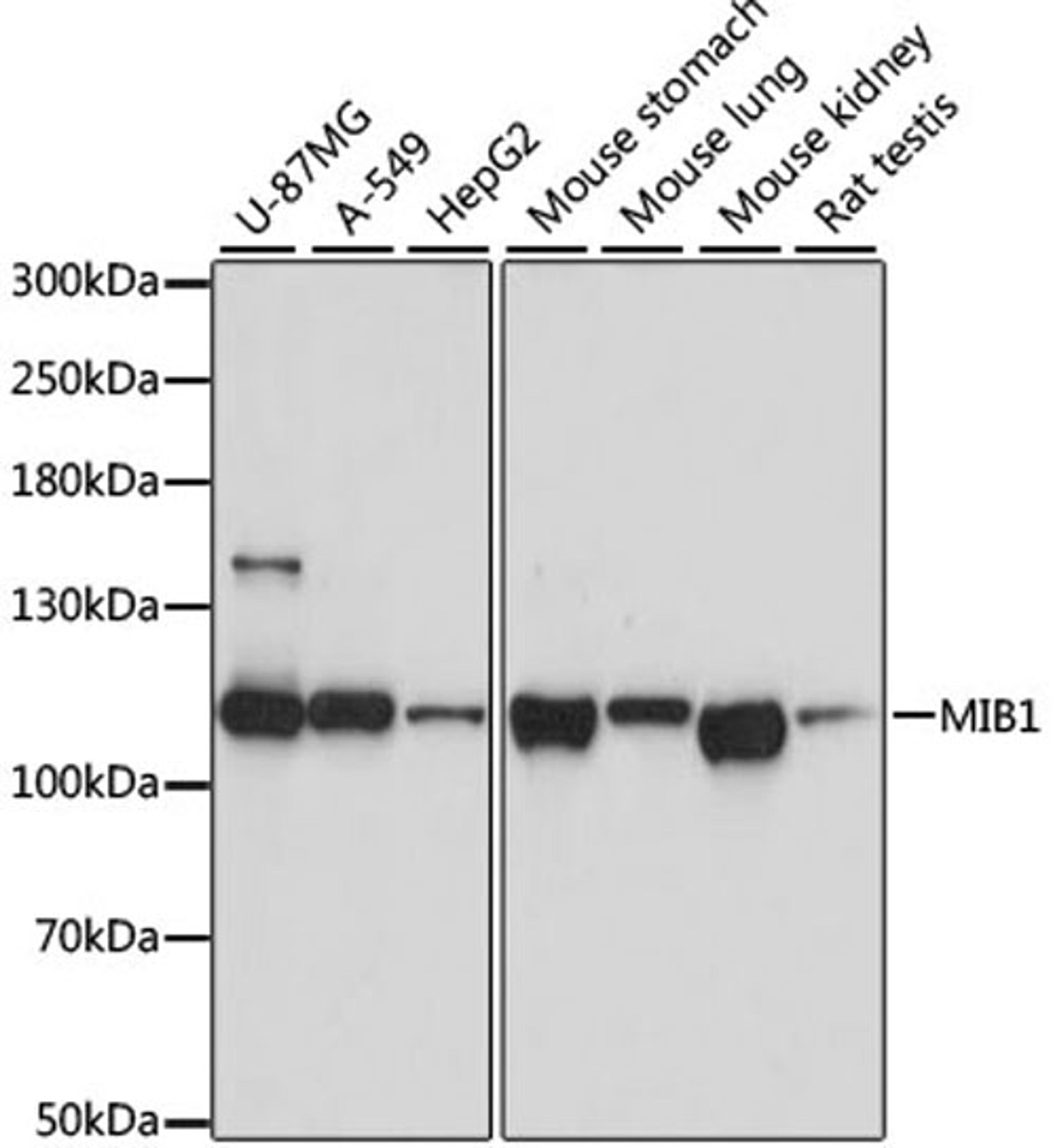 Western blot - MIB1 antibody (A8588)