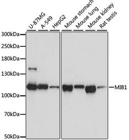 Western blot - MIB1 antibody (A8588)