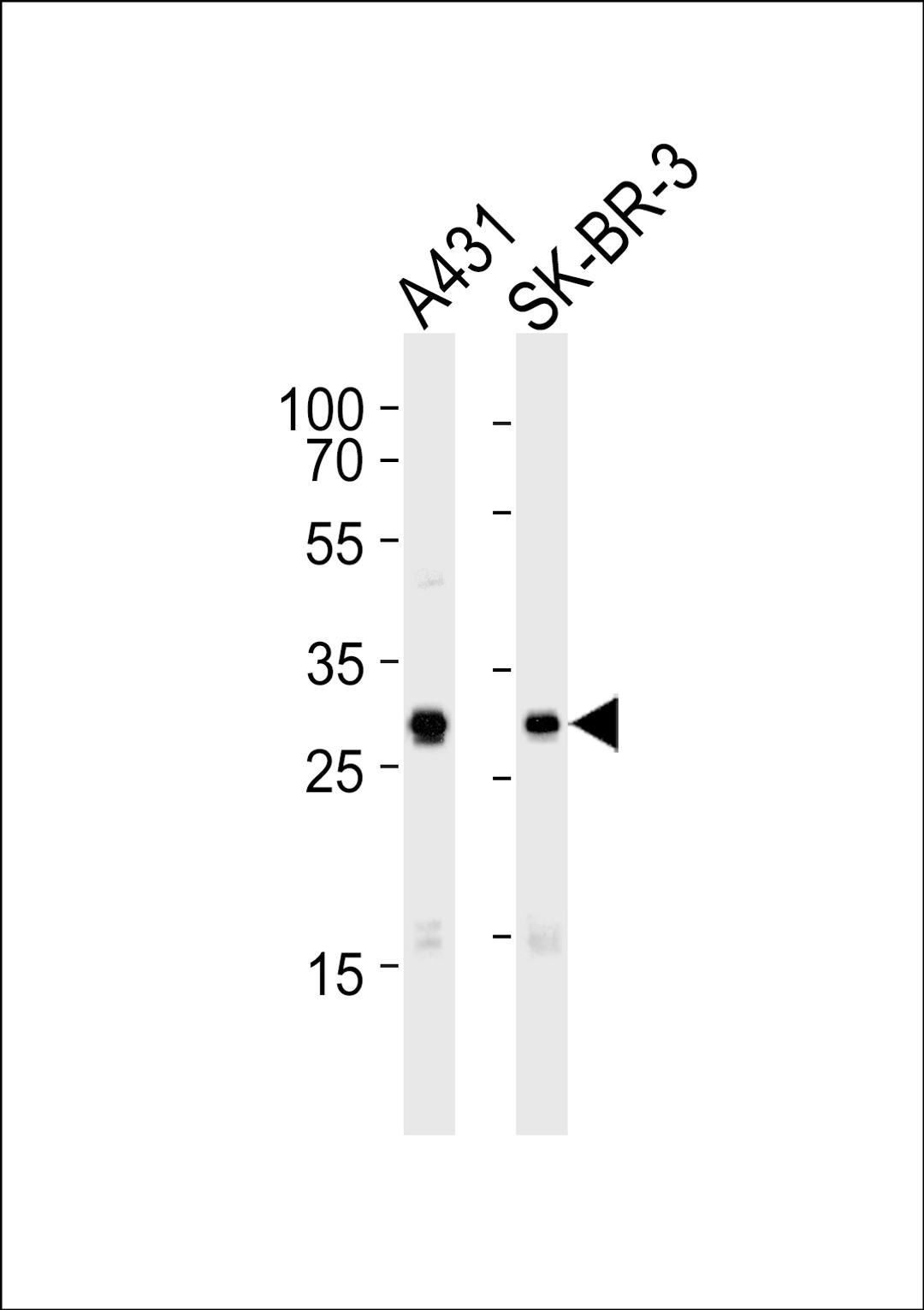 Western blot analysis of lysates from A431, SK-BR-3 cell line (from left to right), using Mouse Cdk1 Antibody at 1:1000 at each lane.