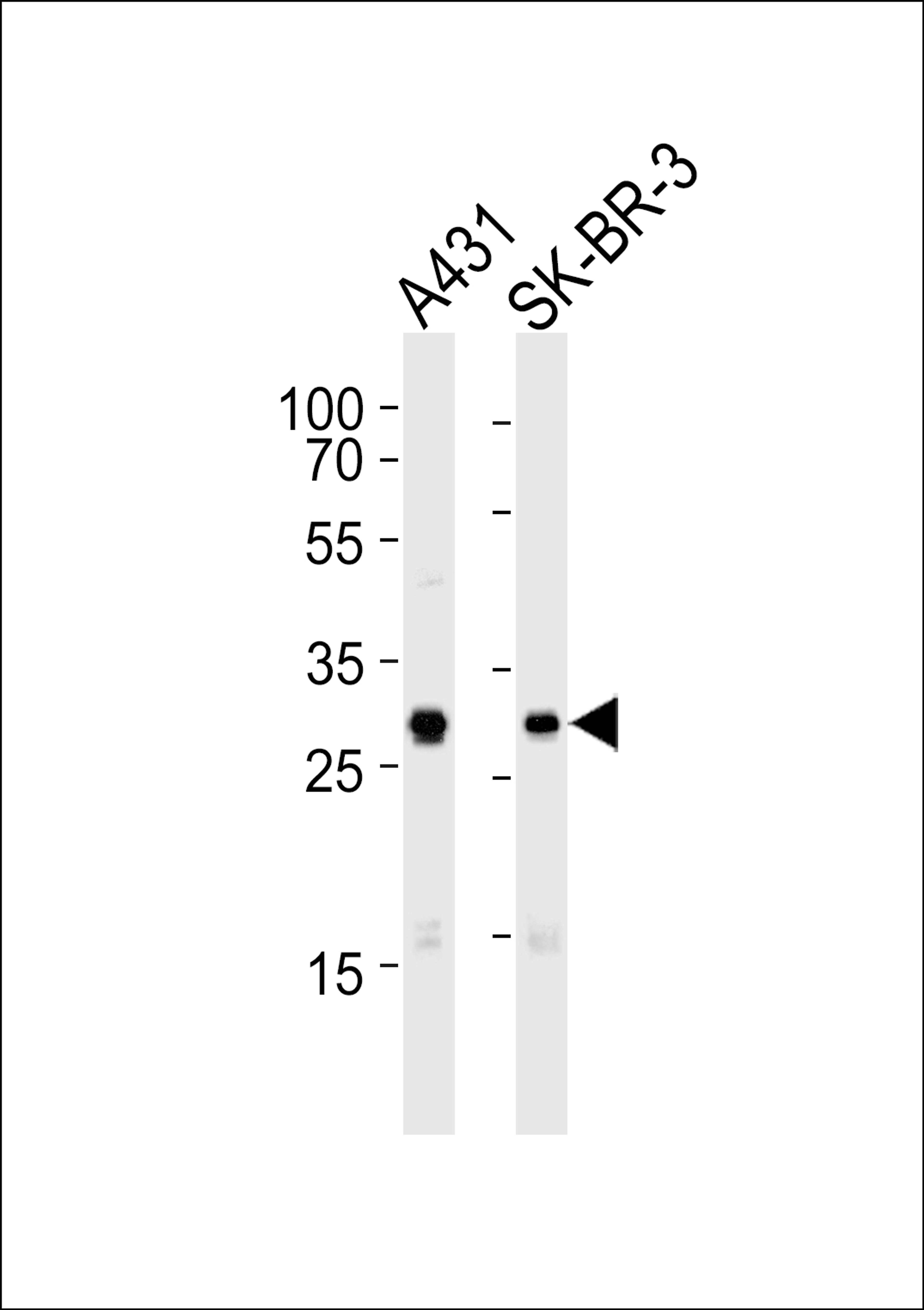 Western blot analysis of lysates from A431, SK-BR-3 cell line (from left to right), using Mouse Cdk1 Antibody at 1:1000 at each lane.