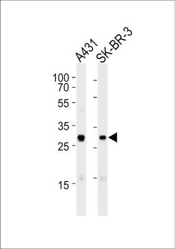Western blot analysis of lysates from A431, SK-BR-3 cell line (from left to right), using Mouse Cdk1 Antibody at 1:1000 at each lane.