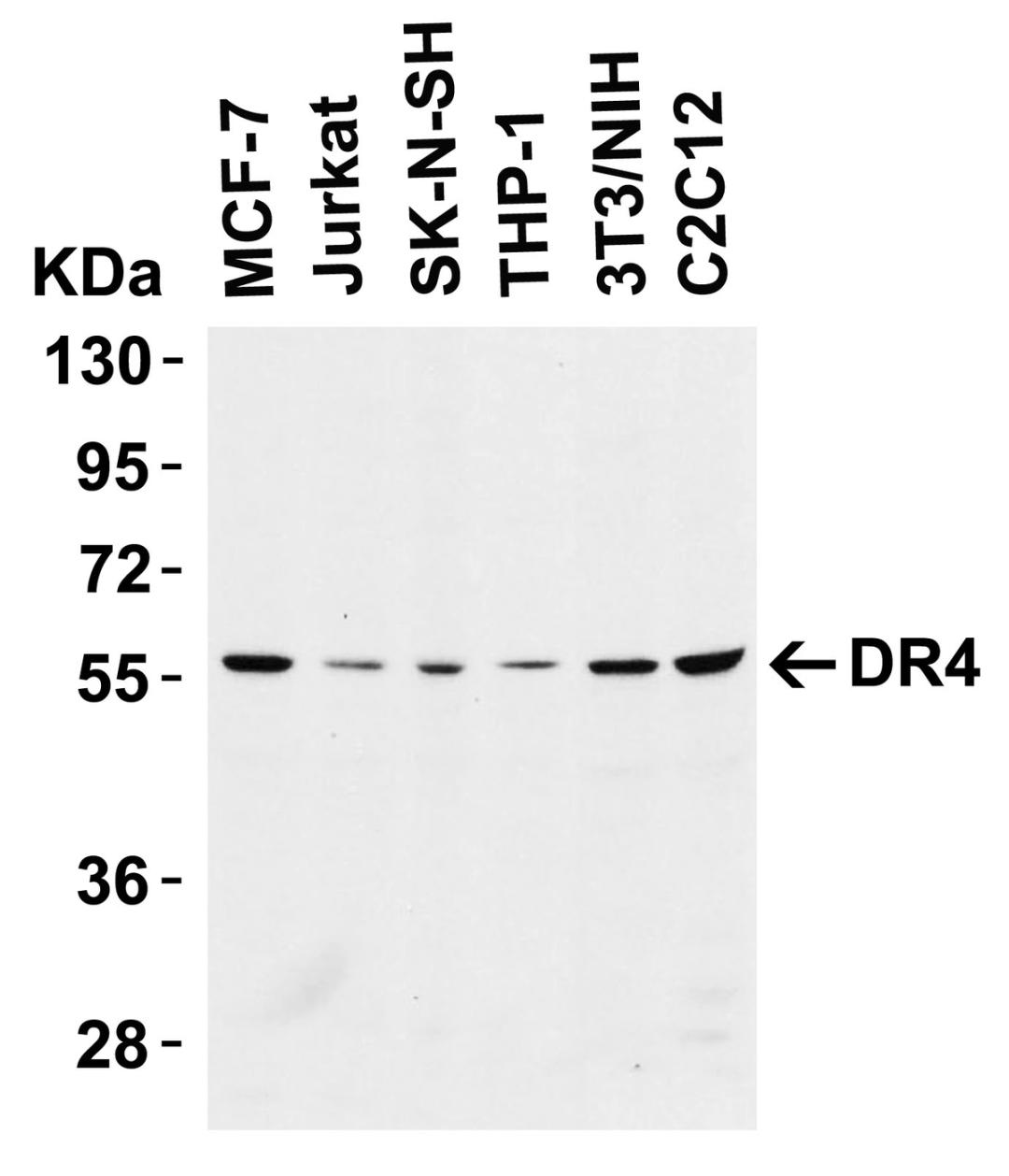 <strong>Figure 1 Western Blot Validation in Cell Lines</strong><br>