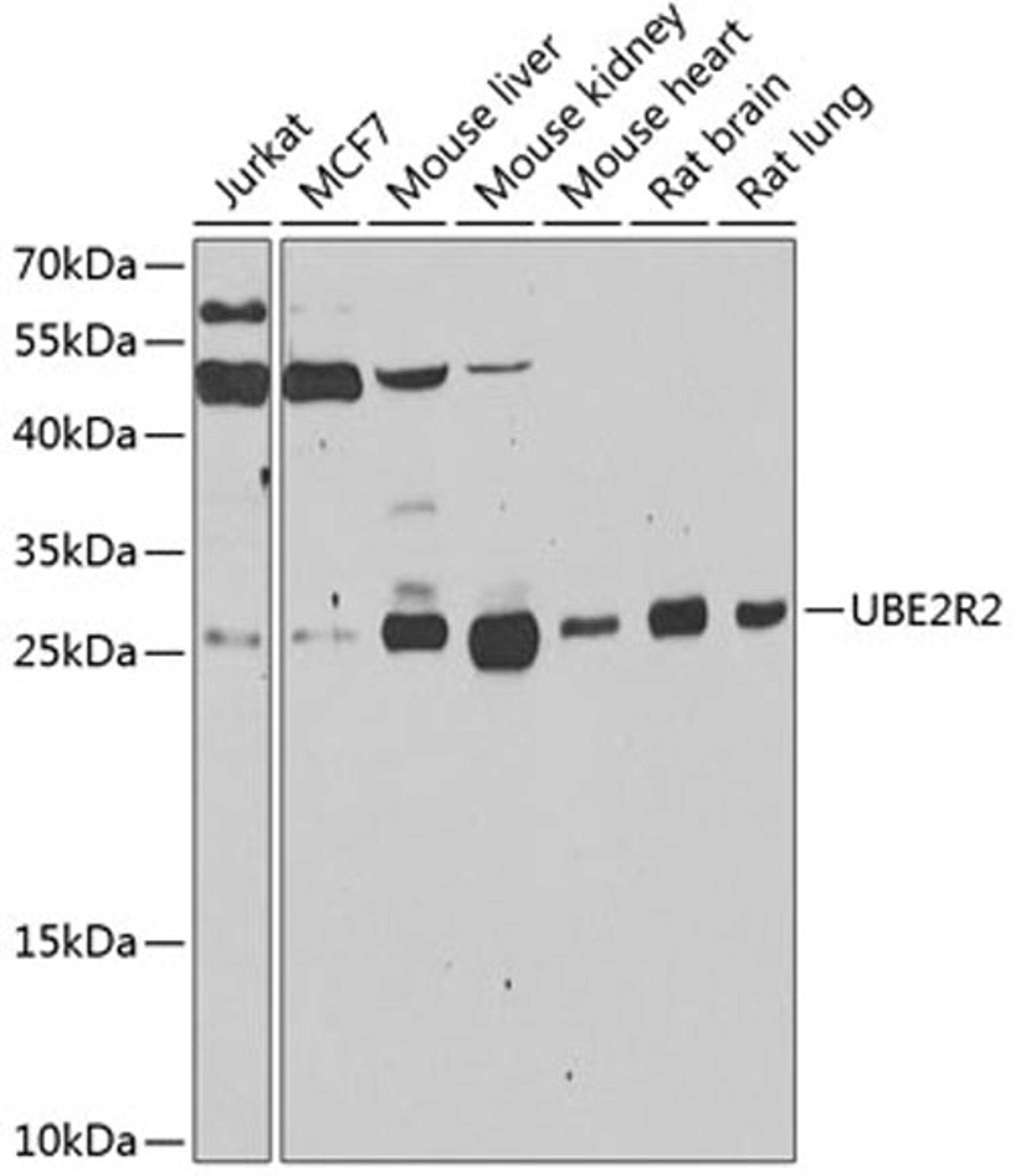 Western blot - UBE2R2 antibody (A7373)