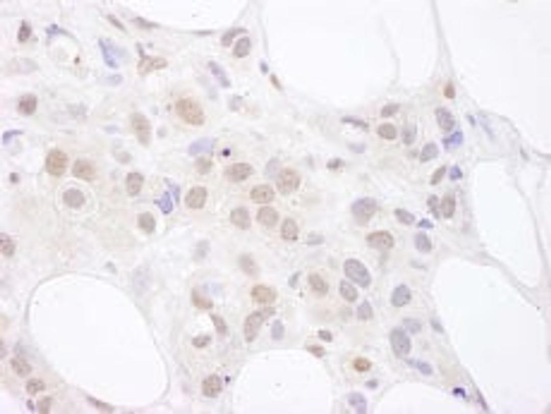 Detection of human U2AF65 by immunohistochemistry.