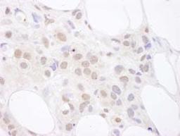 Detection of human U2AF65 by immunohistochemistry.