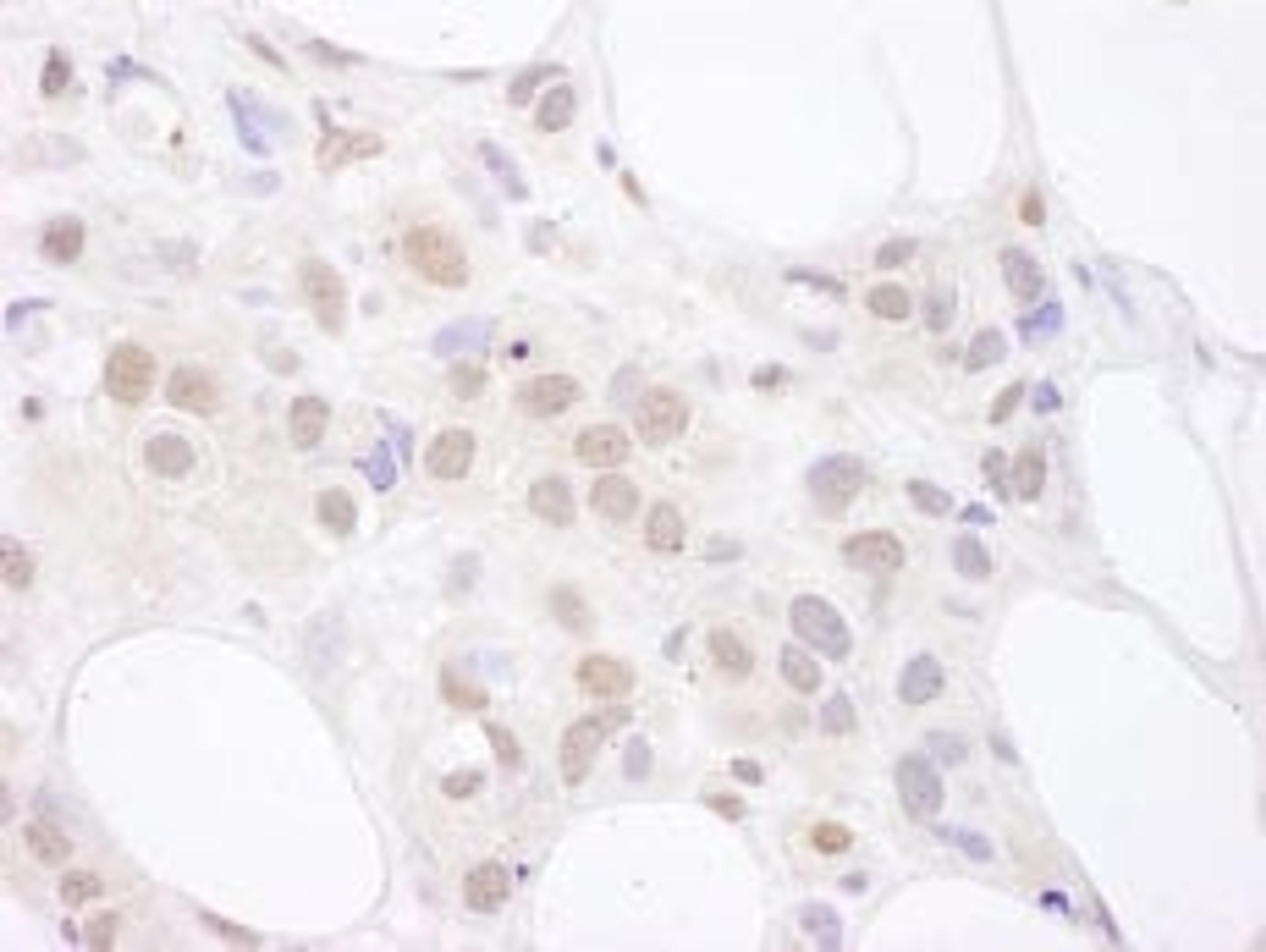 Detection of human U2AF65 by immunohistochemistry.