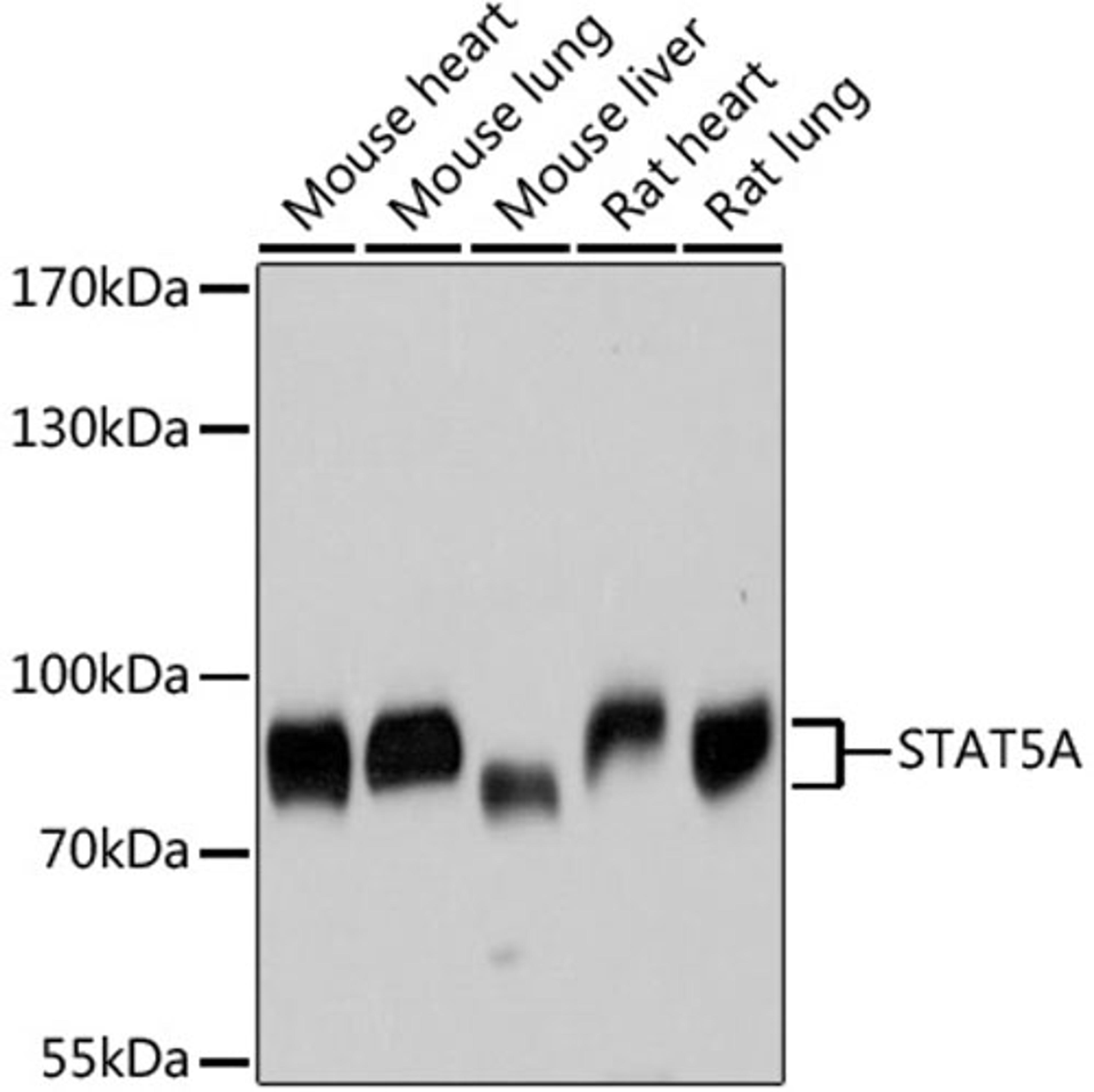 Western blot - STAT5A antibody (A11779)