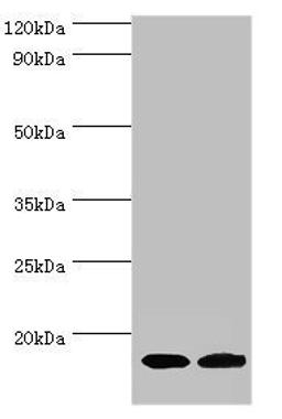Western blot. All lanes: Complexin-2 antibody at 6ug/ml. Lane 1: Rat brain tissue. Lane 2: A549 whole cell lysate. Secondary. Goat polyclonal to rabbit IgG at 1/10000 dilution. Predicted band size: 15 kDa. Observed band size: 15 kDa. 