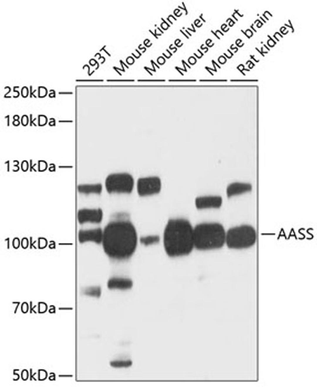 Western blot - AASS antibody (A12863)