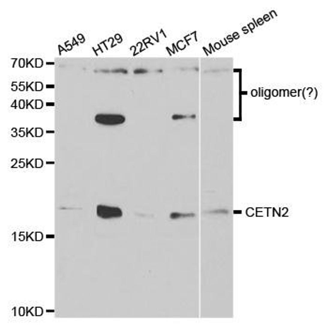 Western blot analysis of extracts of various cell lines using CETN2 antibody