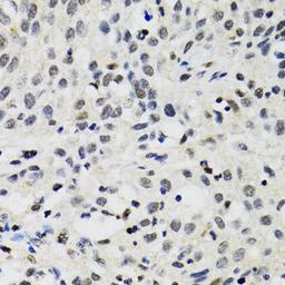 Immunohistochemistry  - SMARCAD1 antibody (A5850)