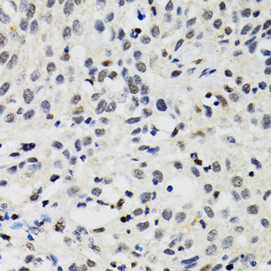 Immunohistochemistry - SMARCAD1 antibody (A5850)