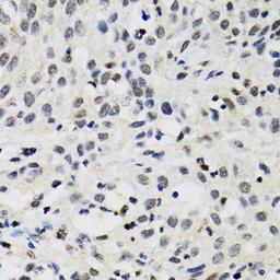 Immunohistochemistry - SMARCAD1 antibody (A5850)