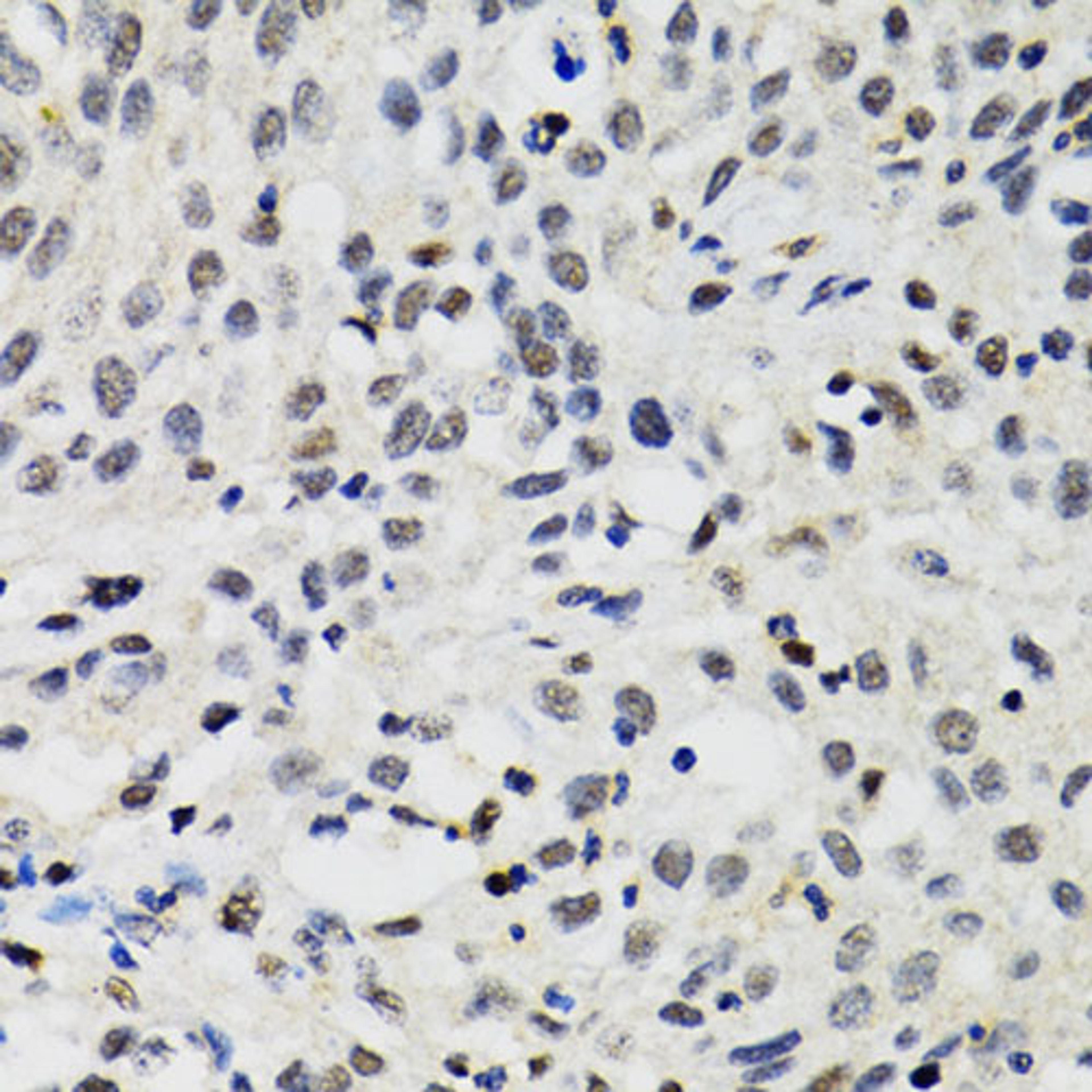 Immunohistochemistry - SMARCAD1 antibody (A5850)