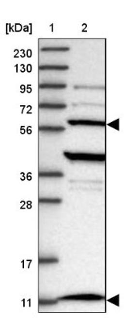 Western Blot: TTC15 Antibody [NBP1-84500] - Lane 1: Marker [kDa] 230, 130, 95, 72, 56, 36, 28, 17, 11<br/>Lane 2: Human cell line RT-4