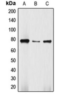 Western blot analysis of Jurkat (Lane 1), HepG2 (Lane 2), SW480 (Lane 3) whole cell lysates using DBF4 antibody