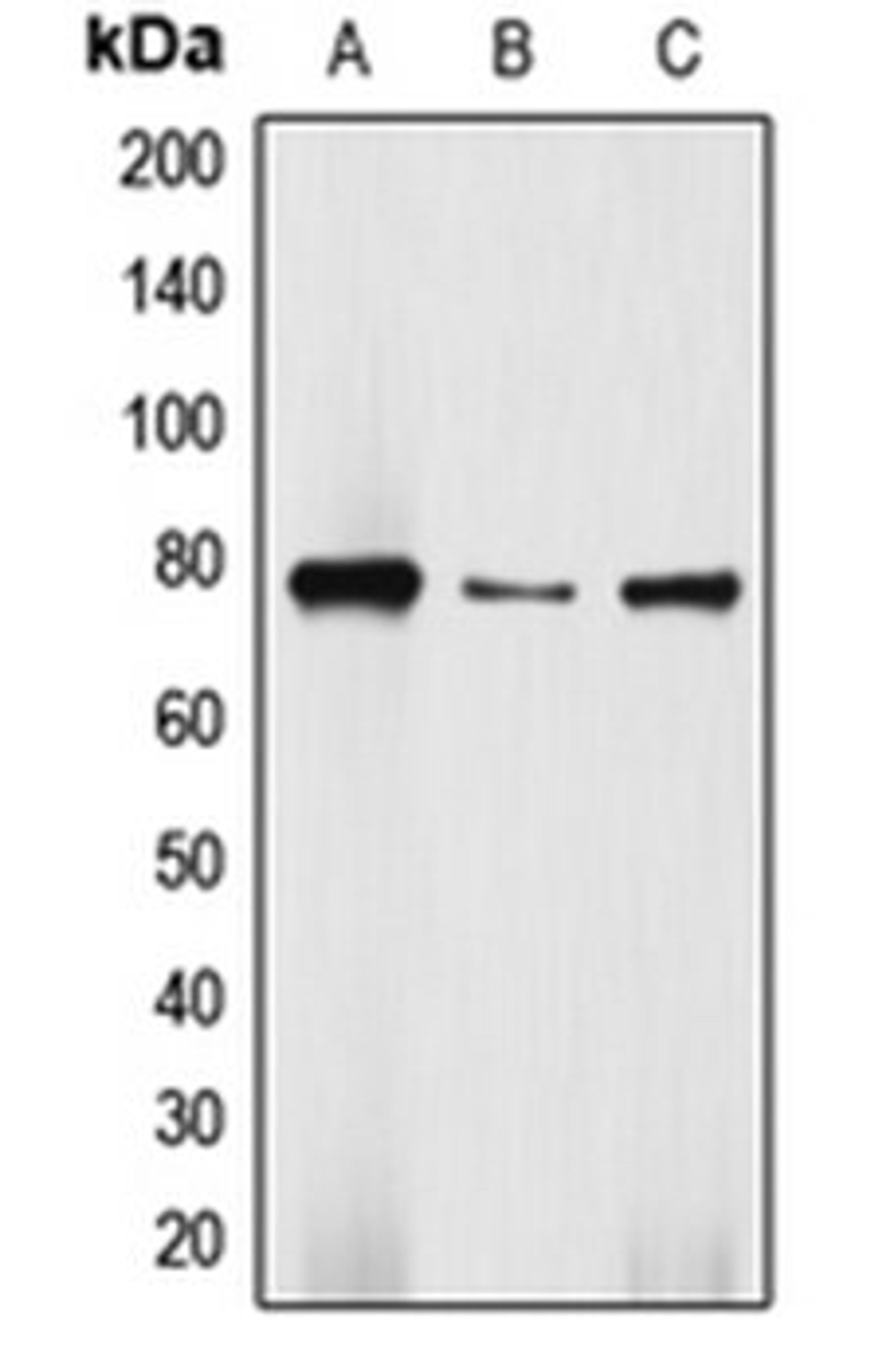 Western blot analysis of Jurkat (Lane 1), HepG2 (Lane 2), SW480 (Lane 3) whole cell lysates using DBF4 antibody