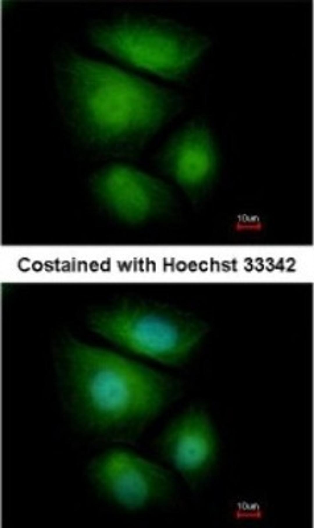 Immunocytochemistry/Immunofluorescence: RNF13 Antibody [NBP1-31251] - Paraformaldehyde-fixed MCF-7, using antibody at 1:500 dilution.