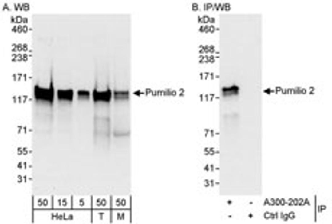 Detection of human and mouse Pumilio 2 by western blot (h&m) and immunoprecipitation (h).