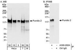 Detection of human and mouse Pumilio 2 by western blot (h&m) and immunoprecipitation (h).