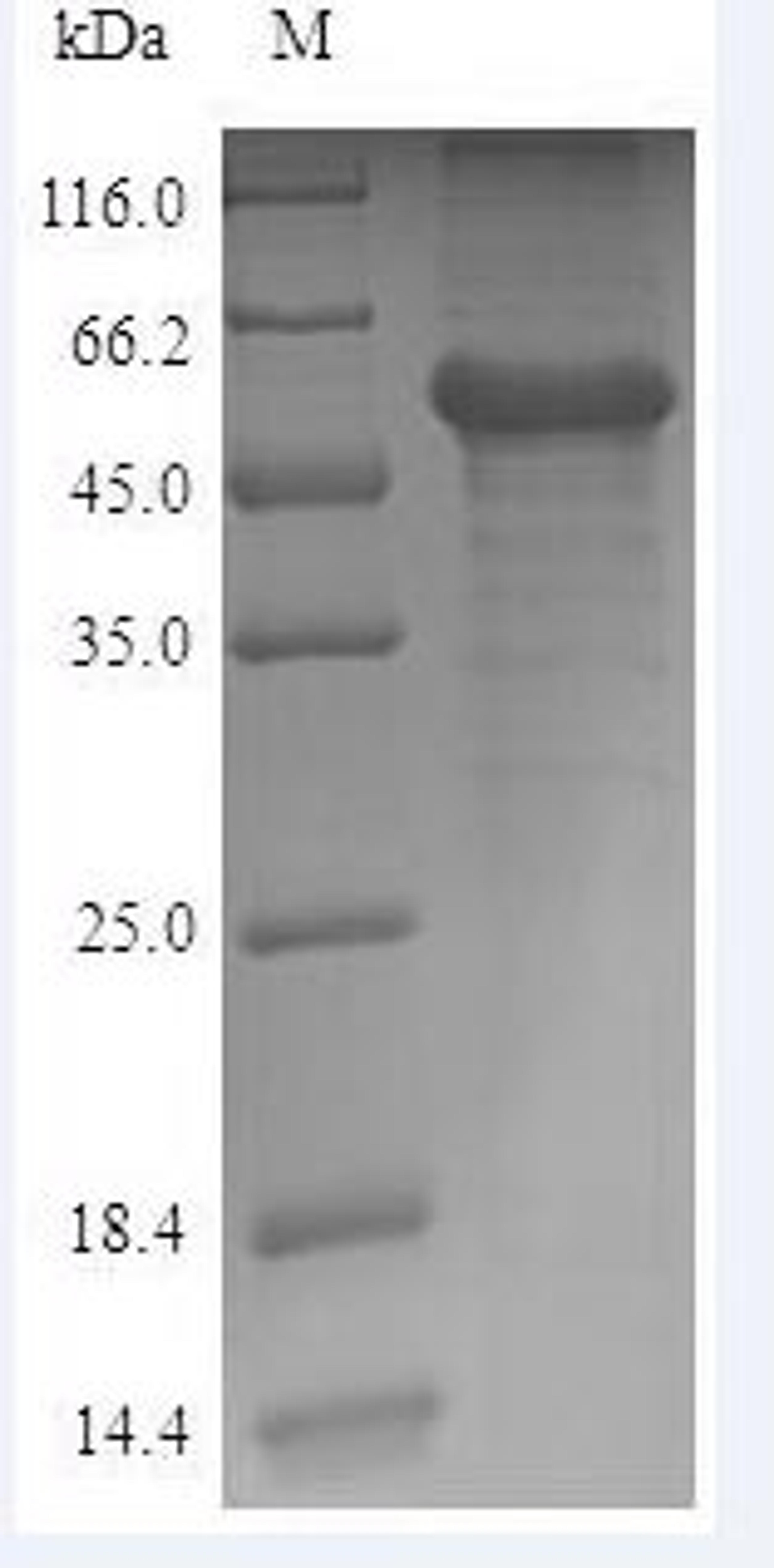 (Tris-Glycine gel) Discontinuous SDS-PAGE (reduced) with 5% enrichment gel and 15% separation gel.