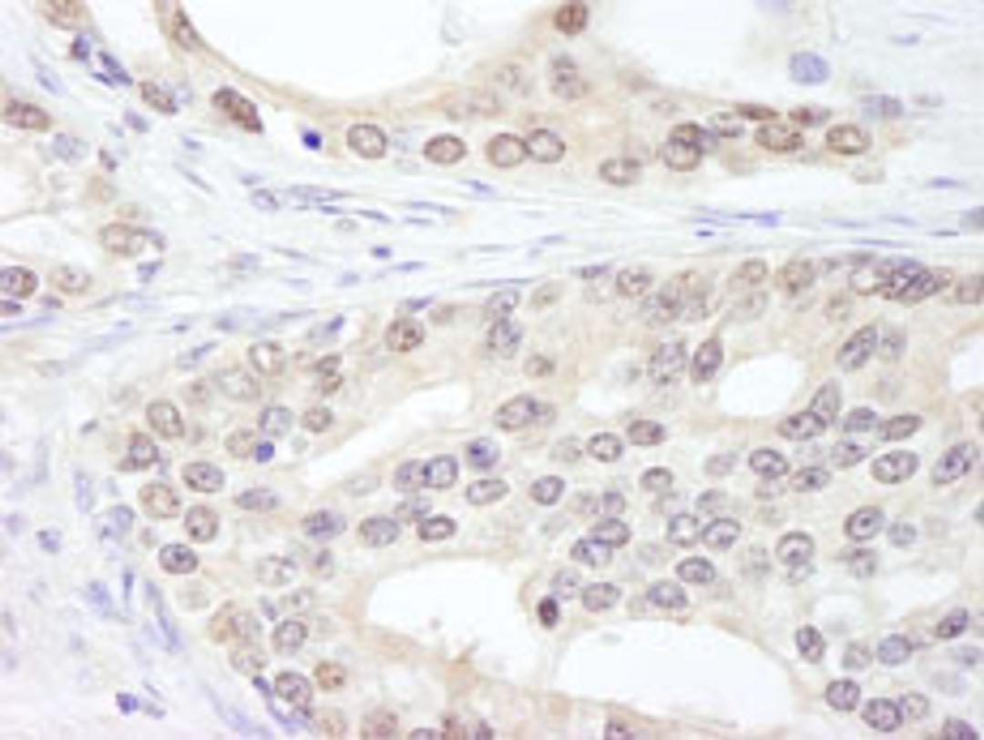 Detection of human SF3a120/SAP114 by immunohistochemistry.