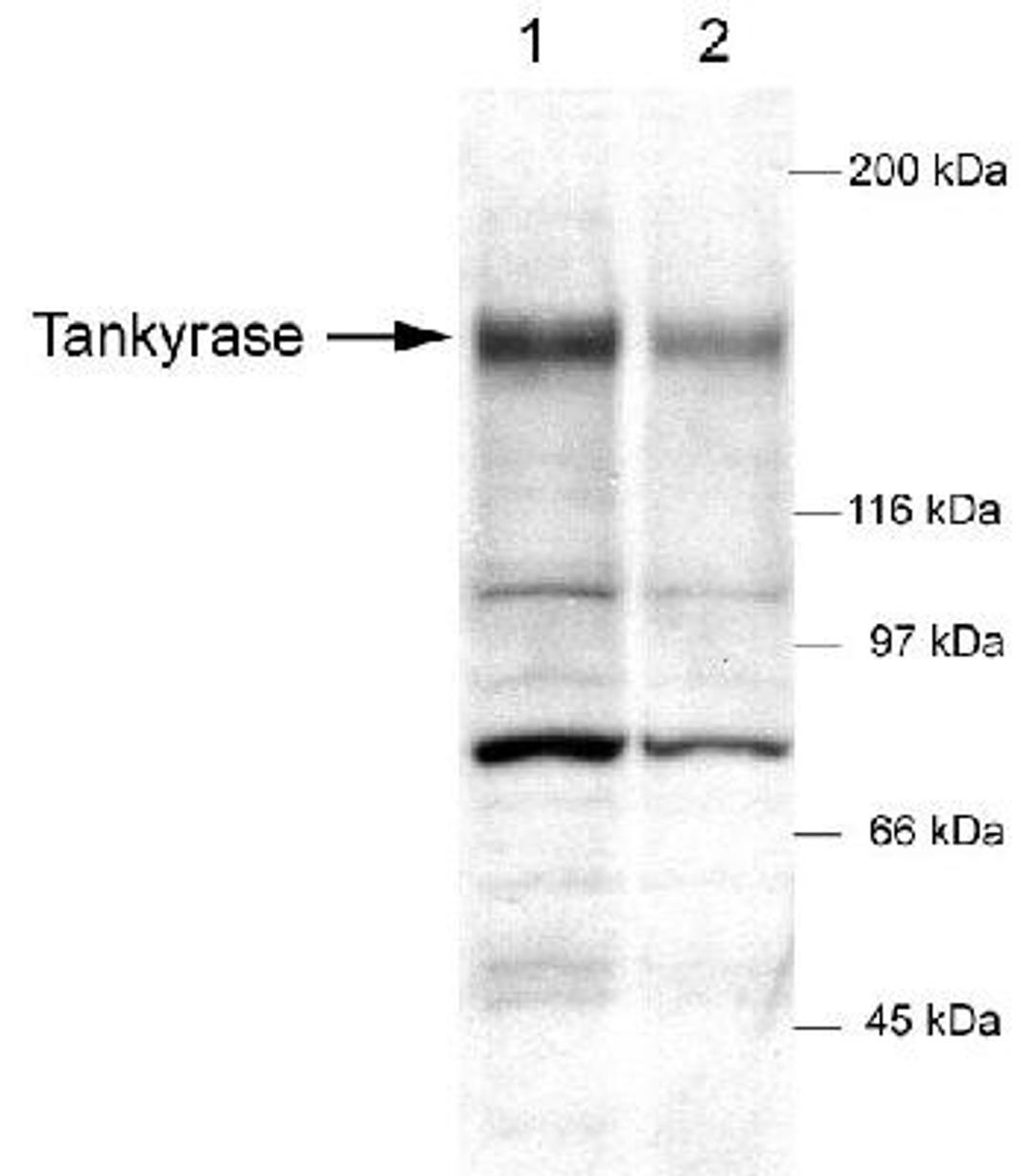 Western Blot: Tankyrase Antibody [NB100-186] - Detection of tankyrase in DU145 whole cell lysates (50 ug) using NB 100-186. ECL detection - 30 seconds. Lane 1 - 1:500 primary dilution Lane 2 - 1:2,000 primary dilution