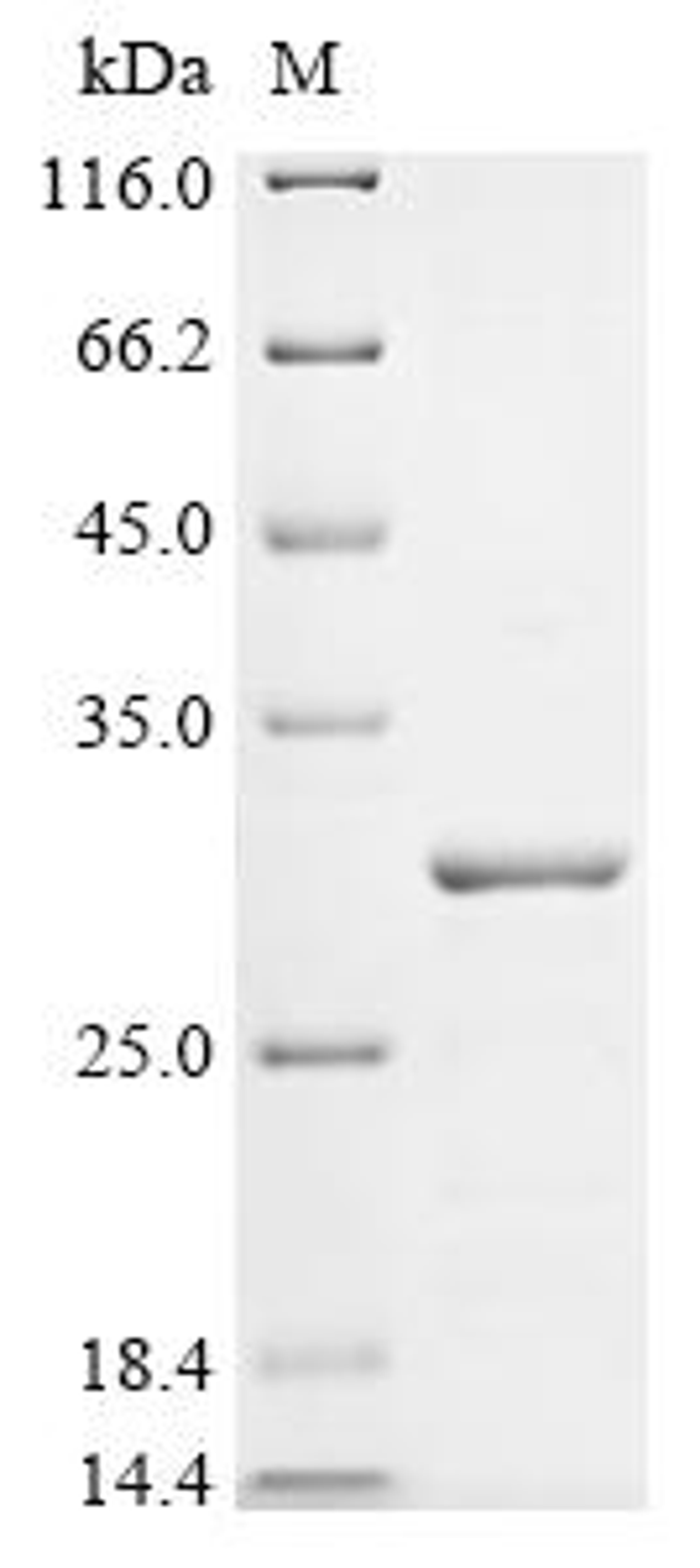 (Tris-Glycine gel) Discontinuous SDS-PAGE (reduced) with 5% enrichment gel and 15% separation gel.