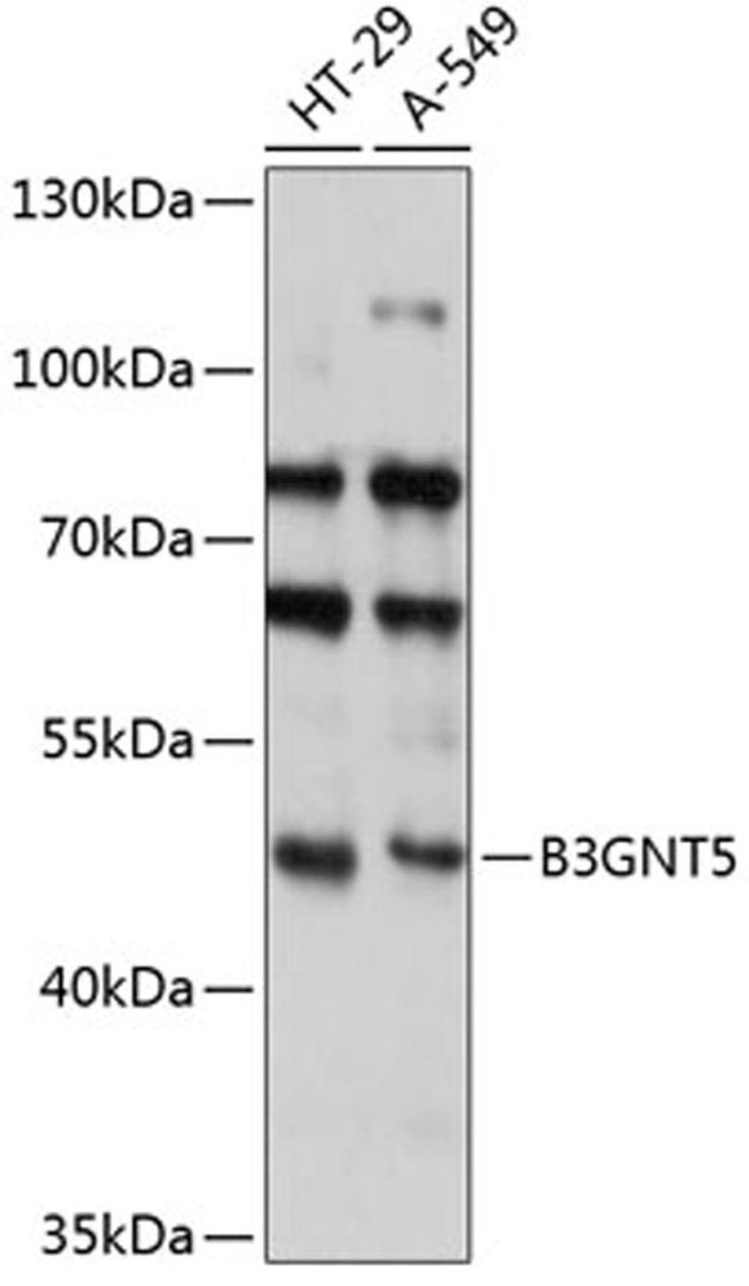 Western blot - B3GNT5 antibody (A14428)