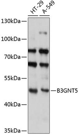 Western blot - B3GNT5 antibody (A14428)