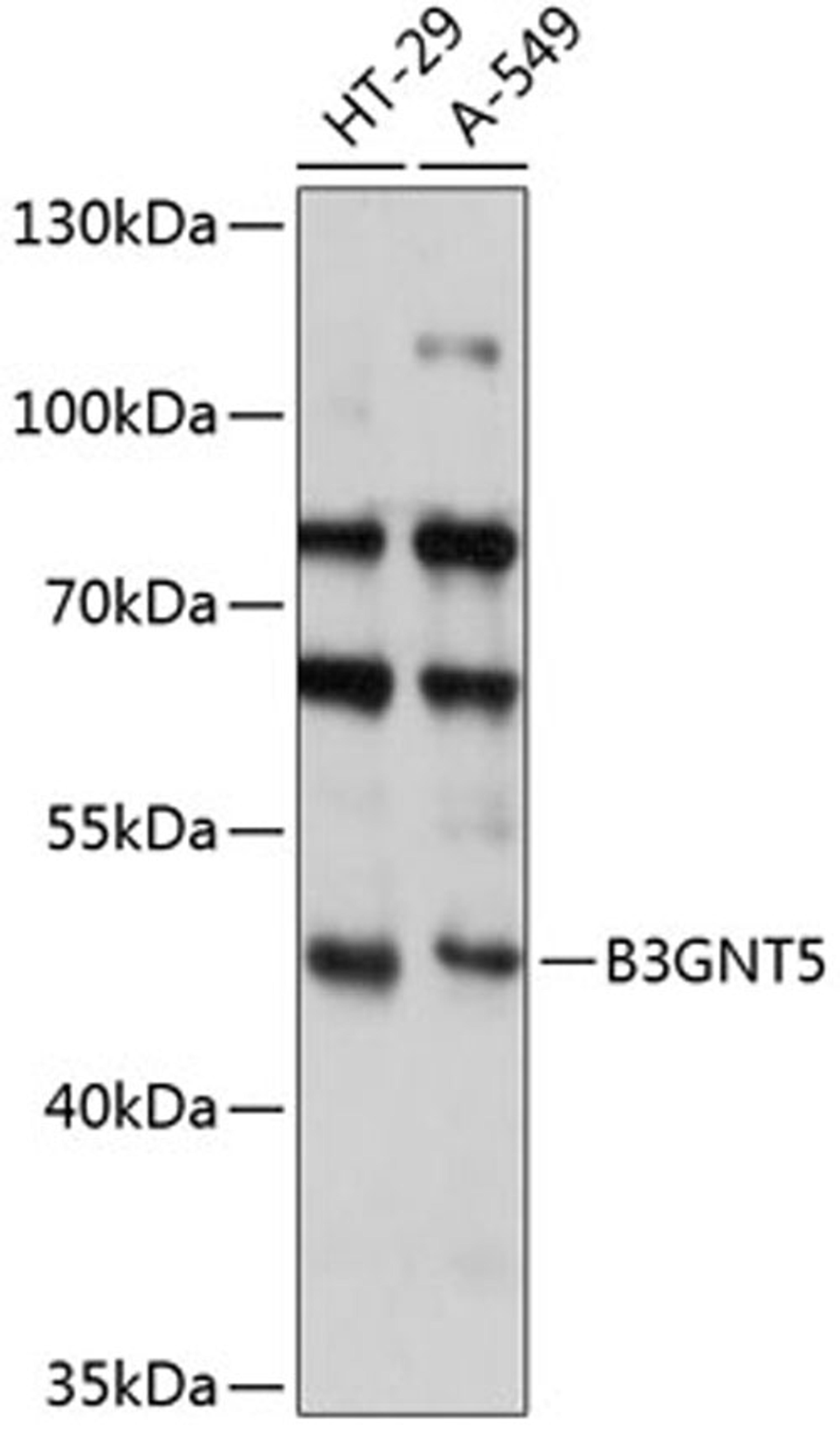 Western blot - B3GNT5 antibody (A14428)