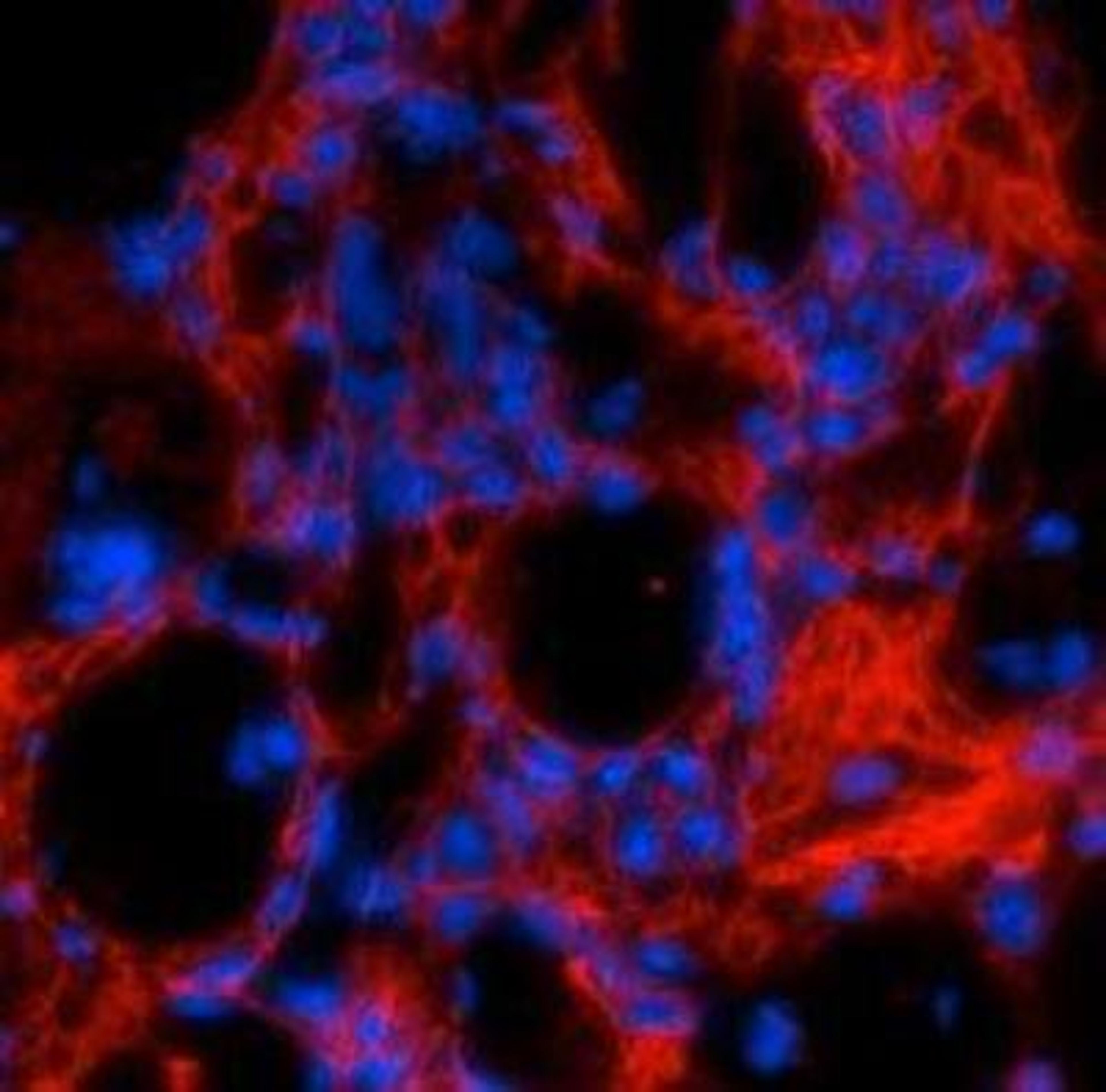 Immunohistochemistry: Collagen I alpha 1 Antibody [NBP1-30054] - Collagen I Antibody [NBP1-30054] - Formaldehyde-fixed fibrotic mouse lung tissue. The antibody recognizes mature collagen I (red) that has formed fibrils in the extracellular matrix.