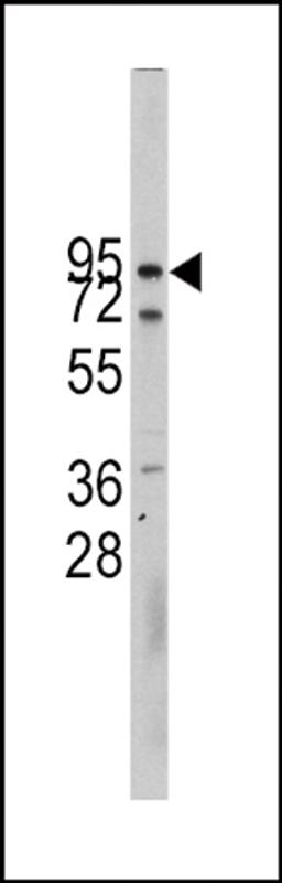 Western blot analysis of CDH10 Antibody in CEM cell line lysates (35ug/lane)