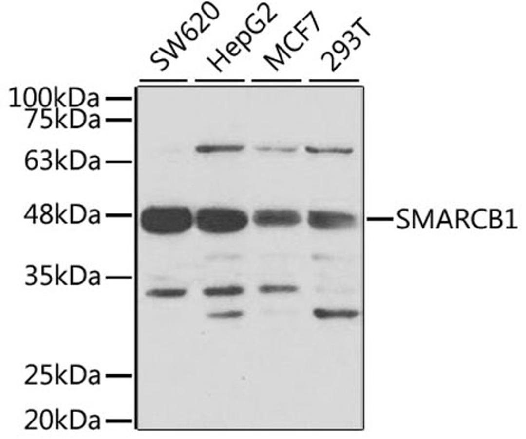 Western blot - SMARCB1 antibody (A5767)