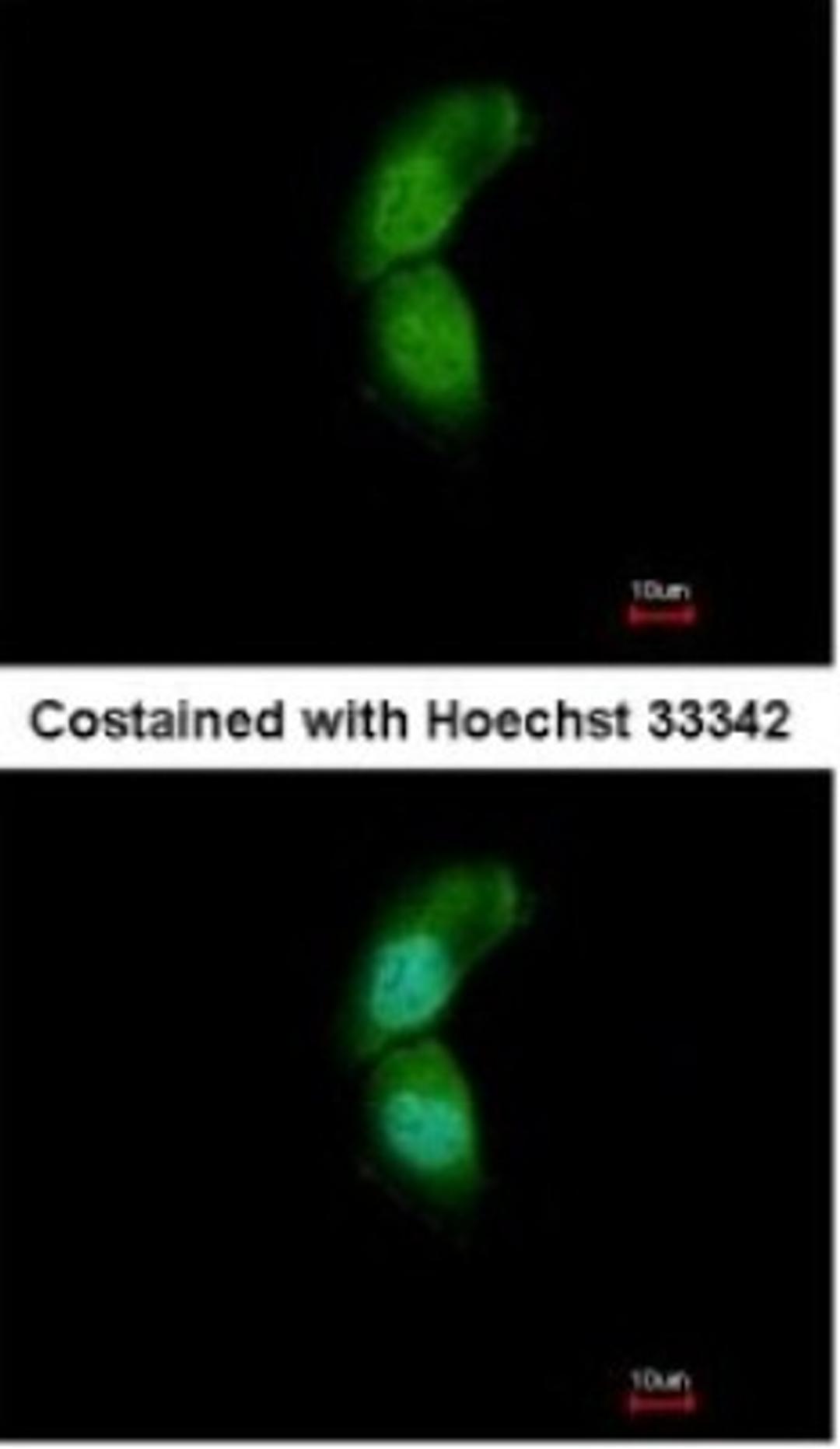 Immunocytochemistry/Immunofluorescence: TRIM32 Antibody [NBP1-33737] - Paraformaldehyde-fixed A431, using antibody at 1:500 dilution.