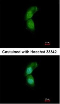 Immunocytochemistry/Immunofluorescence: TRIM32 Antibody [NBP1-33737] - Paraformaldehyde-fixed A431, using antibody at 1:500 dilution.