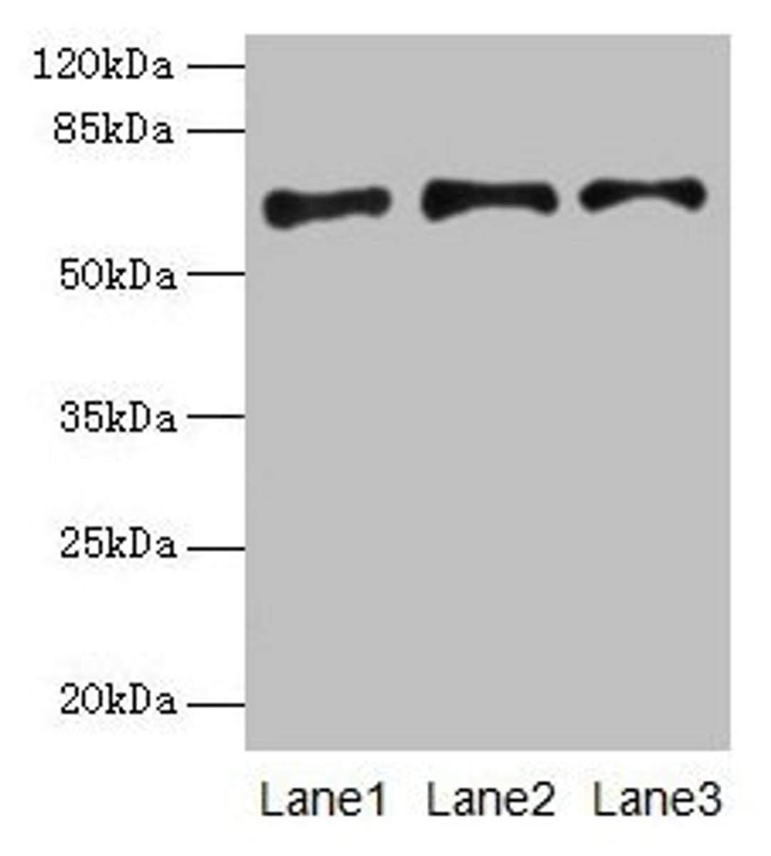 Western blot. All lanes: PLAT antibody at 16µg/ml. Lane 1: Jurkat whole cell lysate. Lane 2: Mouse stomach tissue. Lane 3: Mouse kidney tissue. Secondary. Goat polyclonal to rabbit IgG at 1/10000 dilution. Predicted band size: 63, 33, 58, 45 kDa. Observed band size: 63 kDa