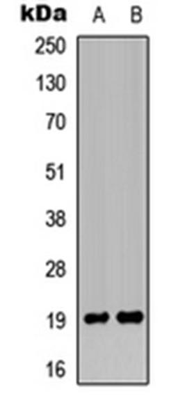 Western blot analysis of Jurkat (Lane 1), rat heart (Lane 2) whole cell lysates using MRPL49 antibody