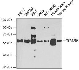 Western blot - TERF2IP antibody (A7981)