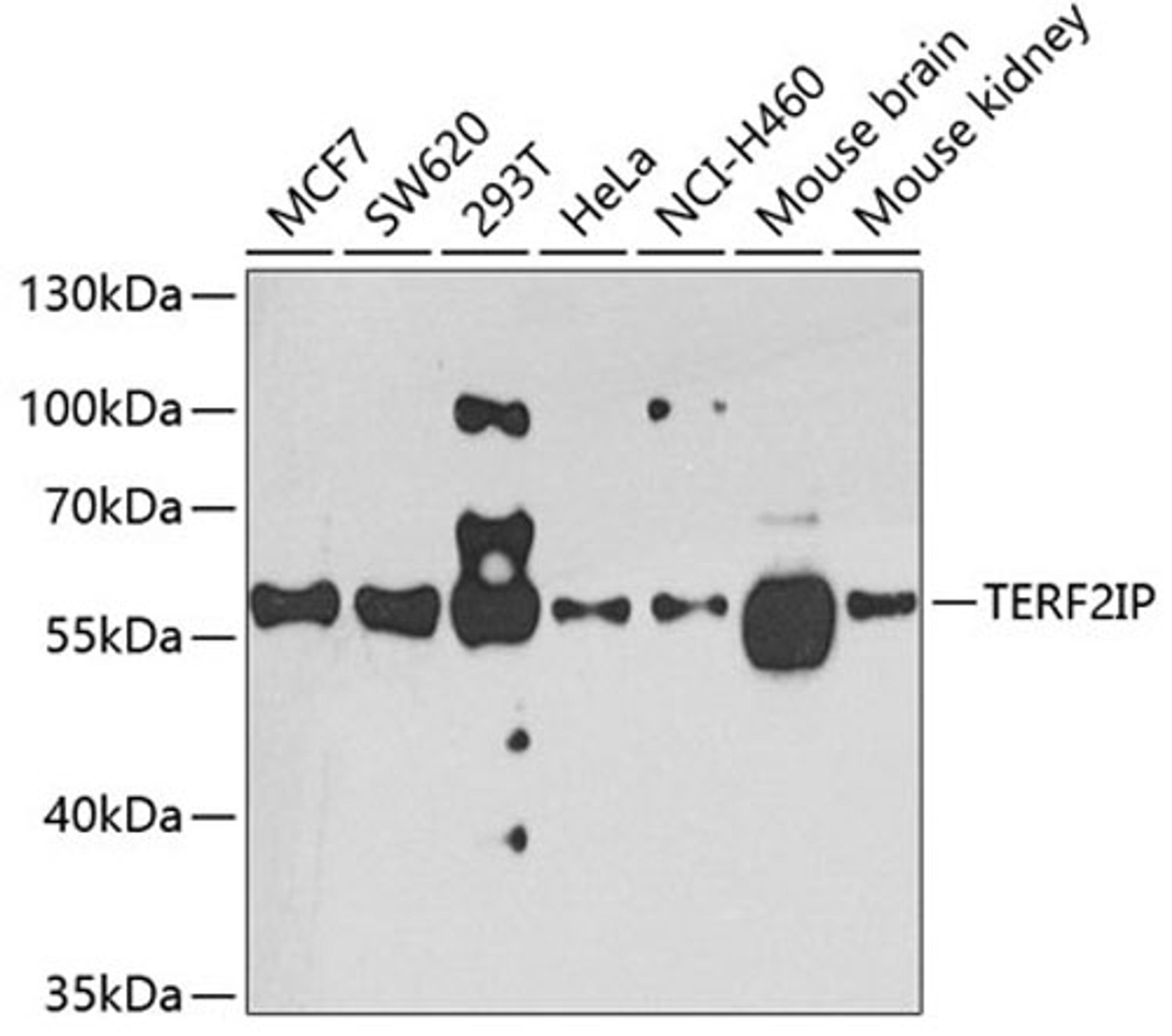 Western blot - TERF2IP antibody (A7981)