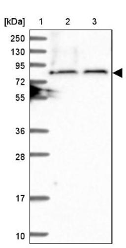 Western Blot: TBC1D30 Antibody [NBP1-93610] - Lane 1: Marker [kDa] 250, 130, 95, 72, 55, 36, 28, 17, 10<br/>Lane 2: Human cell line RT-4<br/>Lane 3: Human cell line U-251MG sp