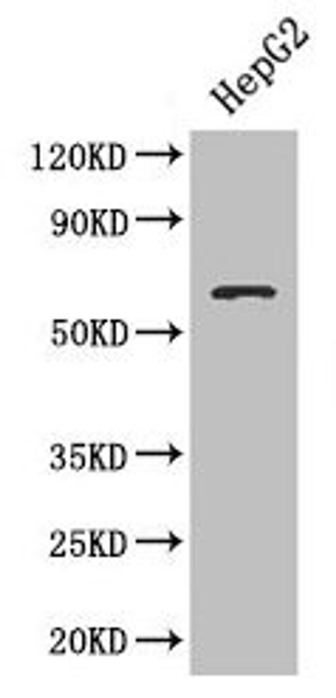 Western blot. All lanes: SMAD4 antibody at 3µg/ml + HepG2 whole cell lysate. Secondary. Goat polyclonal to rabbit IgG at 1/10000 dilution. Predicted band size: 61 kDa. Observed band size: 61 kDa