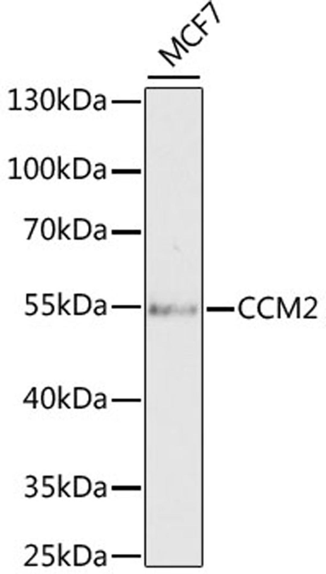 Western blot - CCM2 antibody (A6544)