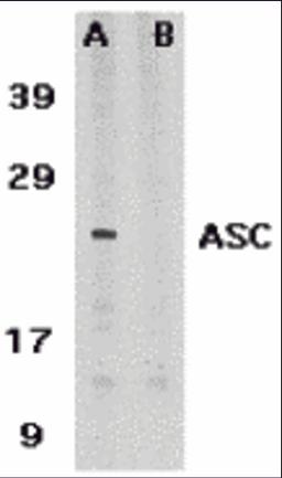 Western blot analysis of ASC in HL60 whole cell lysate in the absence (A) or presence (B) of blocking peptide with ASC antibody at 1 &#956;g /ml. 