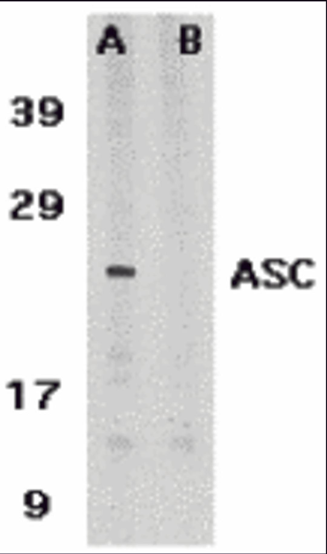 Western blot analysis of ASC in HL60 whole cell lysate in the absence (A) or presence (B) of blocking peptide with ASC antibody at 1 μg /ml.