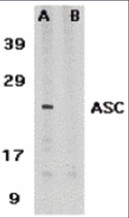 Western blot analysis of ASC in HL60 whole cell lysate in the absence (A) or presence (B) of blocking peptide with ASC antibody at 1 μg /ml.