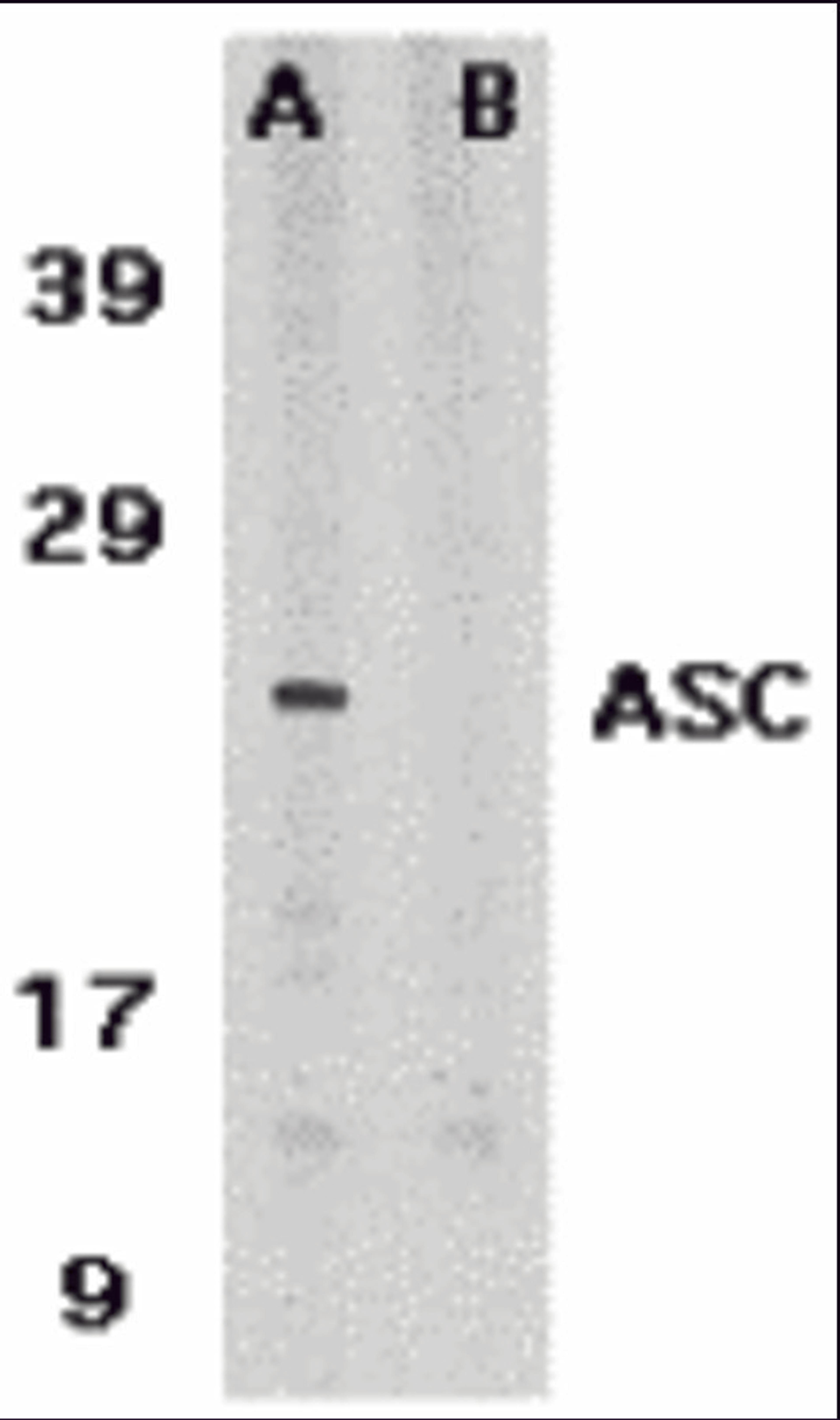 Western blot analysis of ASC in HL60 whole cell lysate in the absence (A) or presence (B) of blocking peptide with ASC antibody at 1 μg /ml.